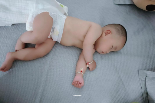 惠州六个月宝宝眼睛散光